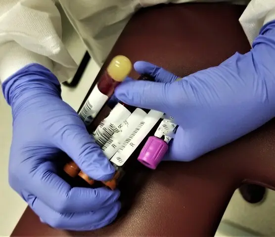 Leucemia .jpg