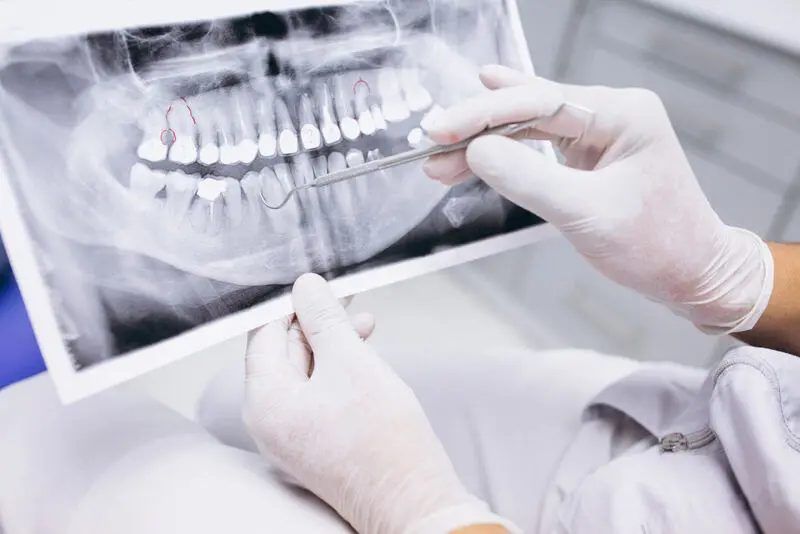dentes.jpg